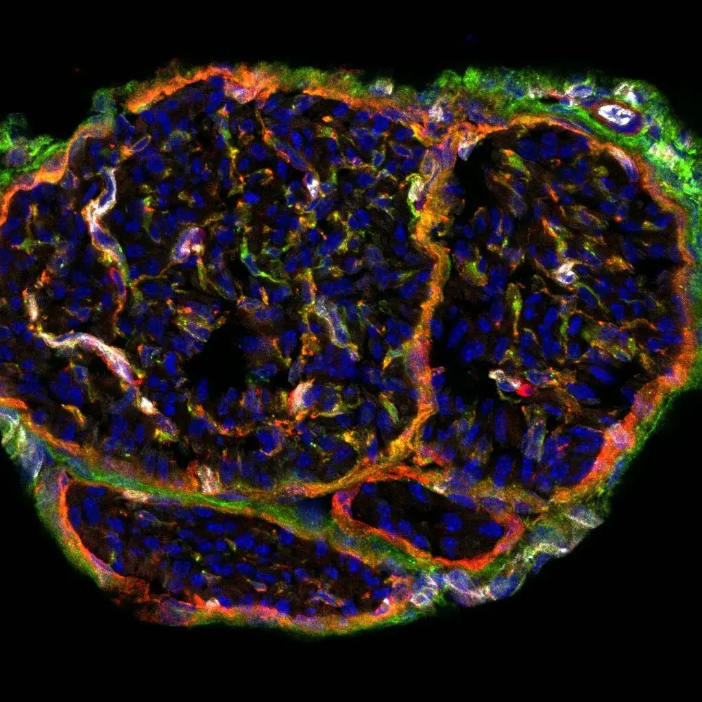 2-blood-nerve-barrier