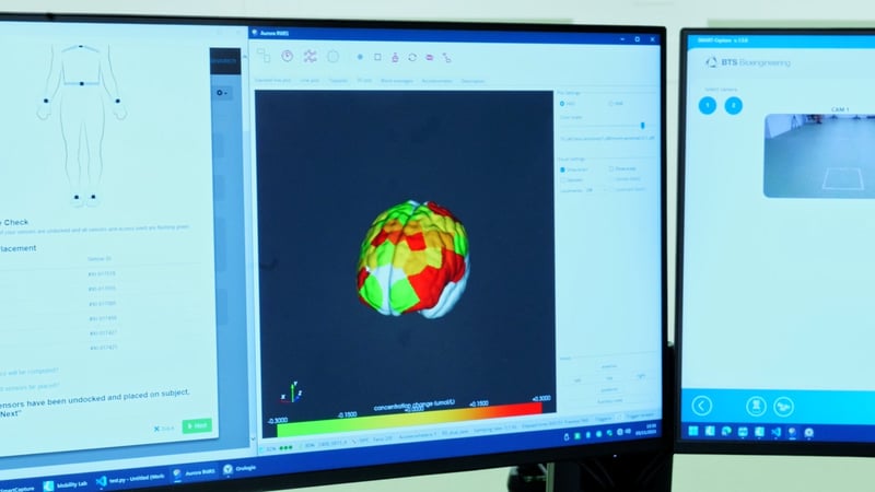 2_Anticorpi_Monoclonali_Alzheimer_Filippi_UniSR
