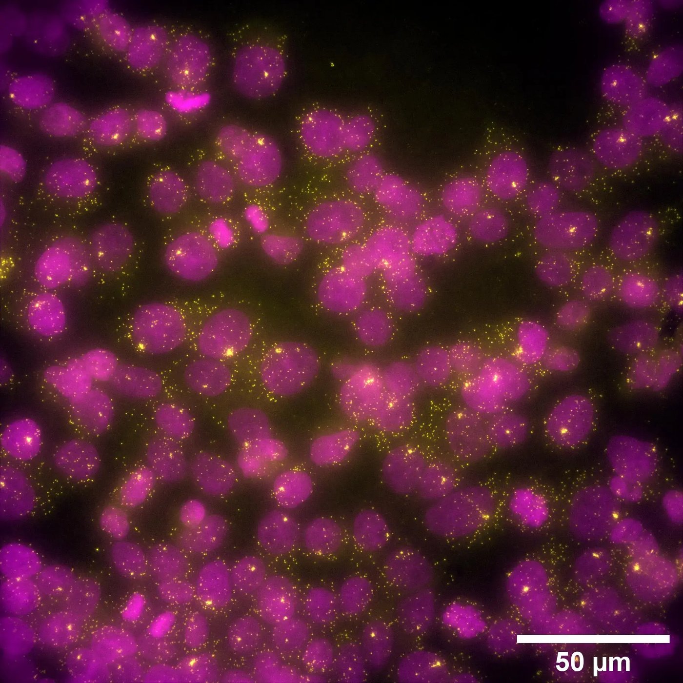 2_p53-role-in-chemoterapy-resistance