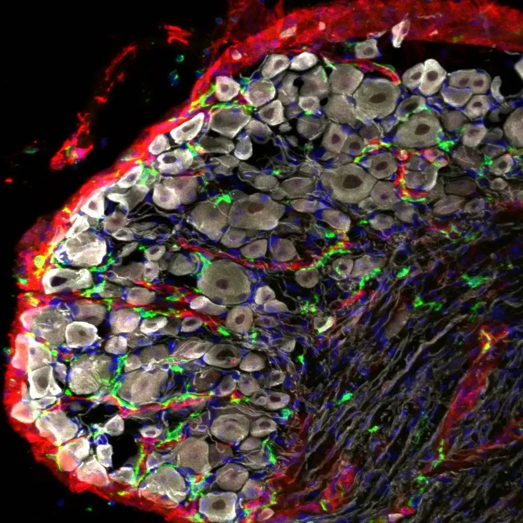 3-blood-nerve-barrier