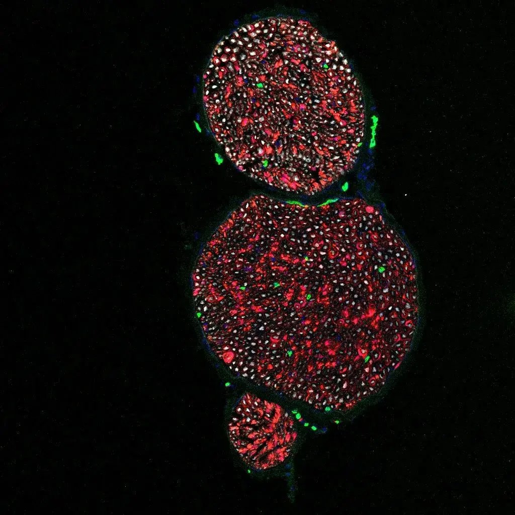 4-blood-nerve-barrier