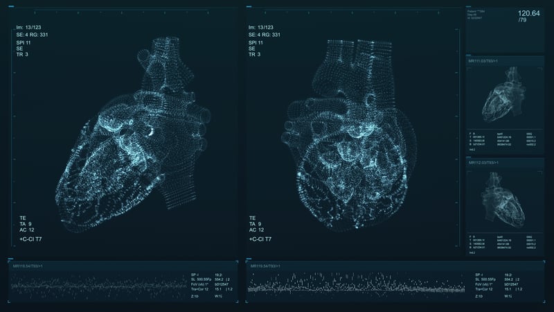 AI_Cuore_imaging_diagnosi_coronarie_infarto_miocardio_UniSR (6)