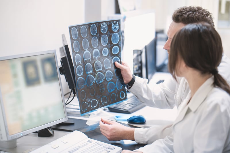 Alzheimer_diagnosi_AI_4_UniSR