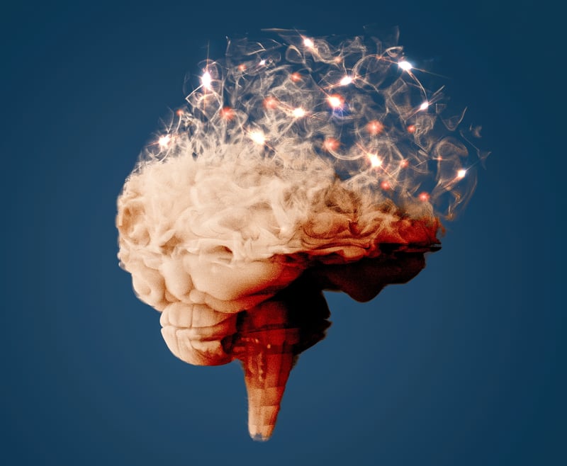 Alzheimer_diagnosi_AI_UniSR (6)