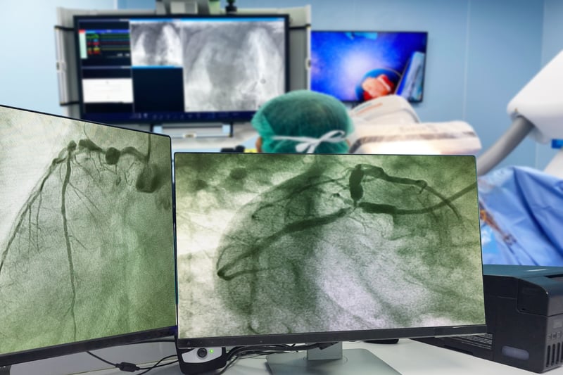 Cardiochirurgia_UniSR (1)