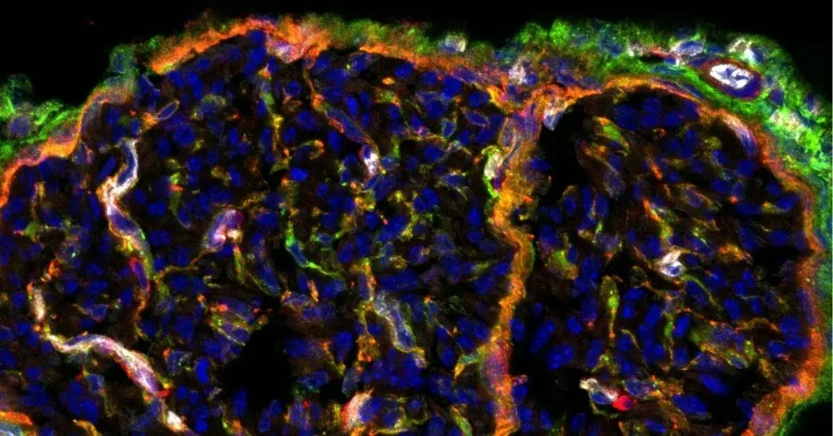 The blood-nerve barrier at the heart of the MINerVA project