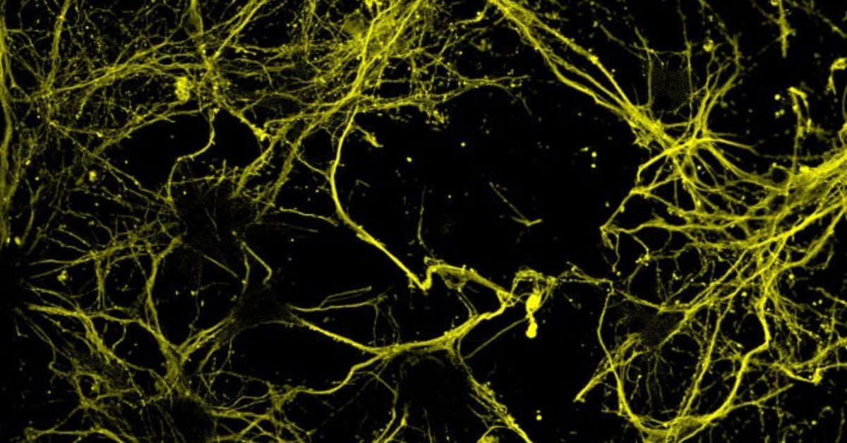 Stimolazione cerebrale a ultrasuoni: studiare emozioni e processi decisionali nel cervello umano
