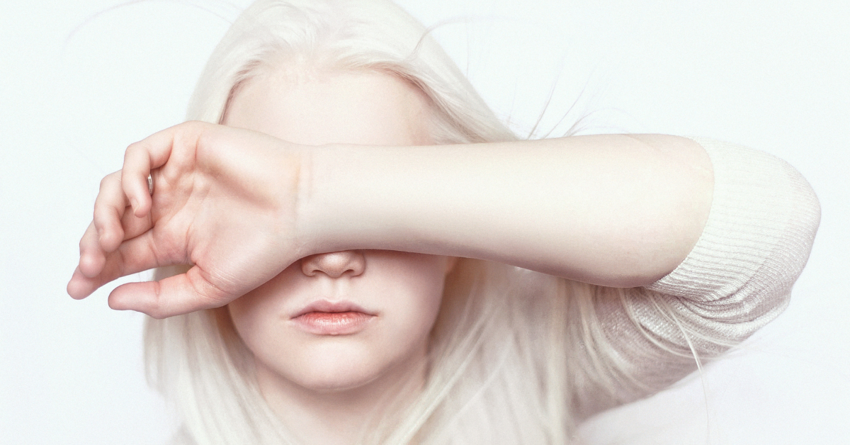 Albinism Awareness day, against superstition and discrimination